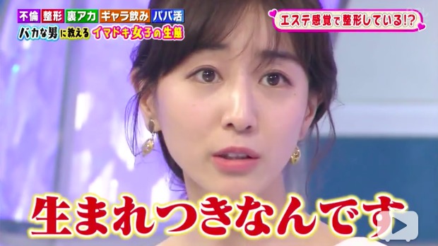 田中みな実 整形